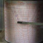 A cylindrical recording device with red grid paper showing purple ink lines drawn by a moving pen that tracks measurements over time.